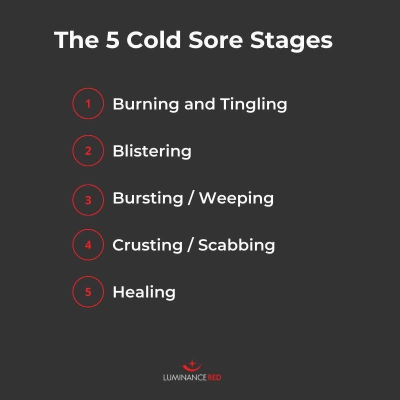 How long are cold sores contagious