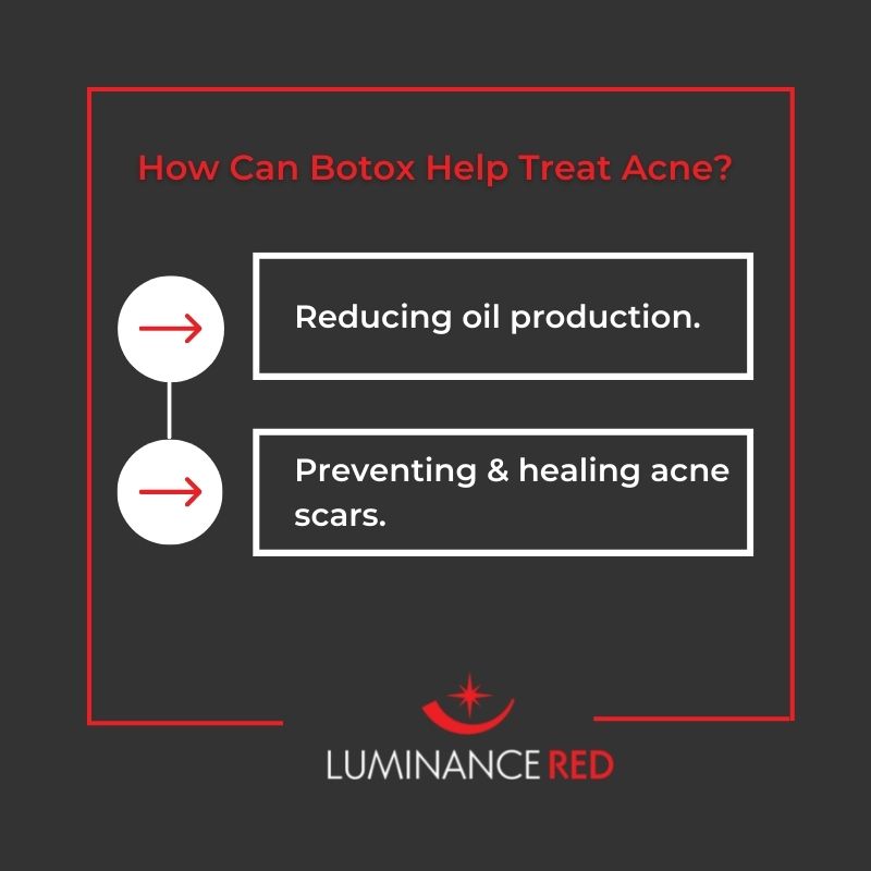 Infographic: Can Botox Help Acne, or Does It Make It Worse?