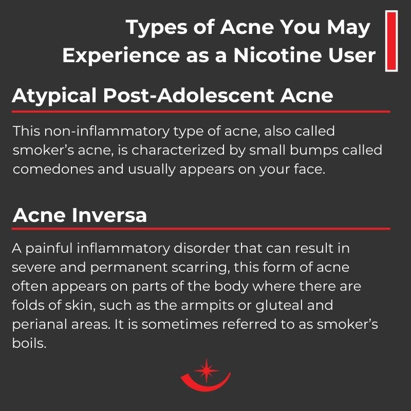 Infographic: Does Nicotine Cause or Contribute to Acne?