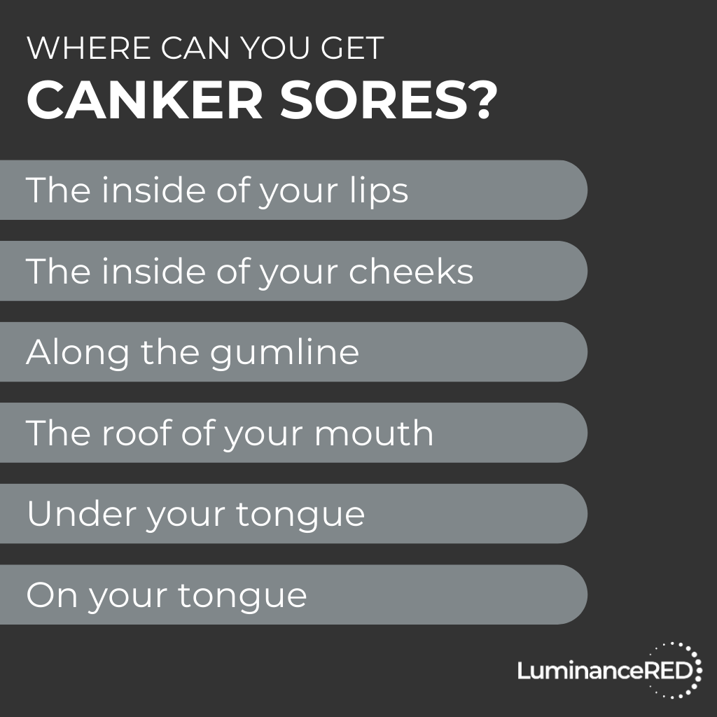 Infographic: Do Chronic Canker Sores Hint at Autoimmune Conditions?