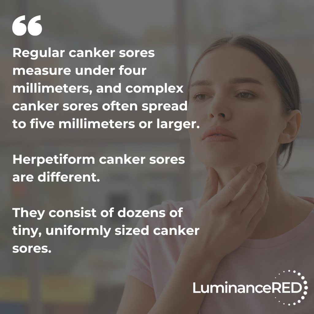 Quote: Herpetiform Canker Sores: Everything You Need to Know