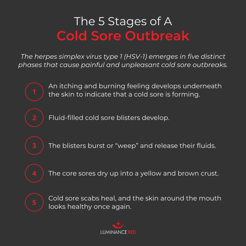 stages of a herpes outbreak