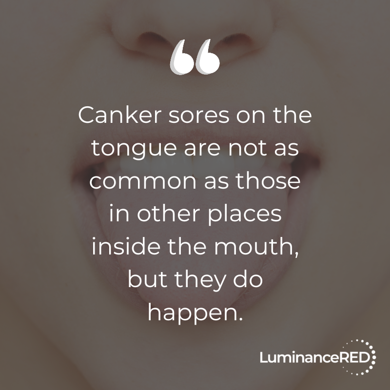 Quote: How to Treat Canker Sores on Your Tongue